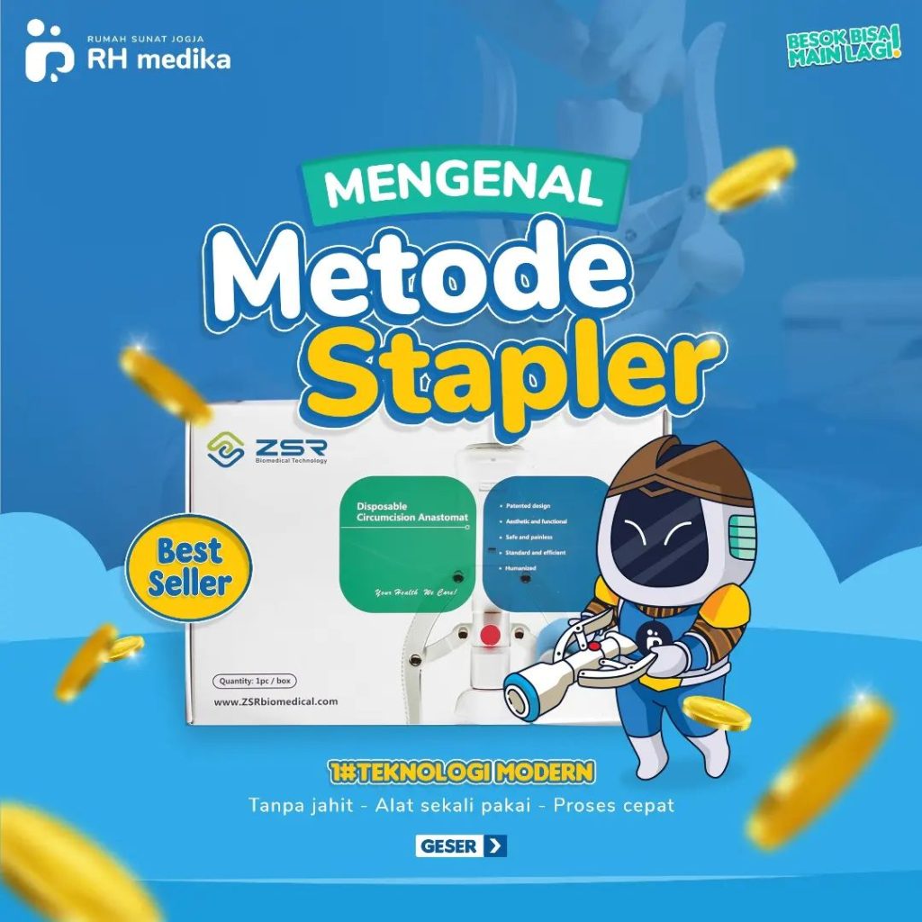 Metode Sunat Stapler: Canggih, Cepat, dan Minim Risiko